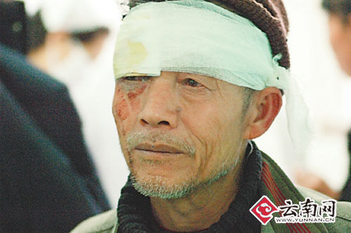 云南一公交车撞墙致22人受伤